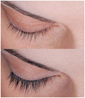 Latisse Eyelash Enhancement Pittsburgh PA